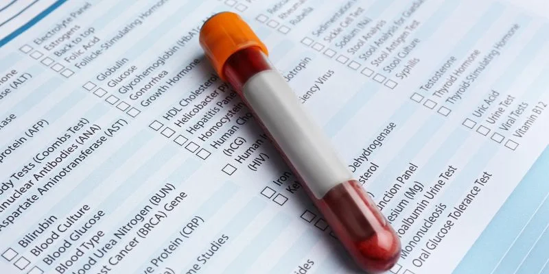 How to Interpret Blood Test Results