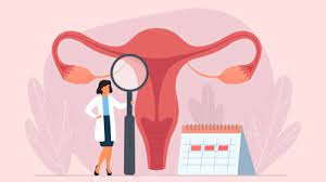 What Causes Irregular Periods and How to Fix Them