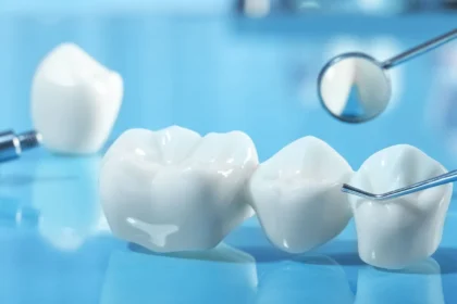 How Dental Polishers Enhance the Longevity and Quality of Restorations